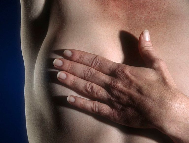 Hospitais do RJ serão obrigados a divulgar direito à cirurgia para mulheres com câncer de mama