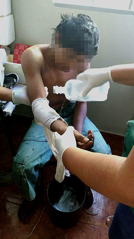 Jovem de 17 anos está em estado mais grave, com uma bala alojada no tórax