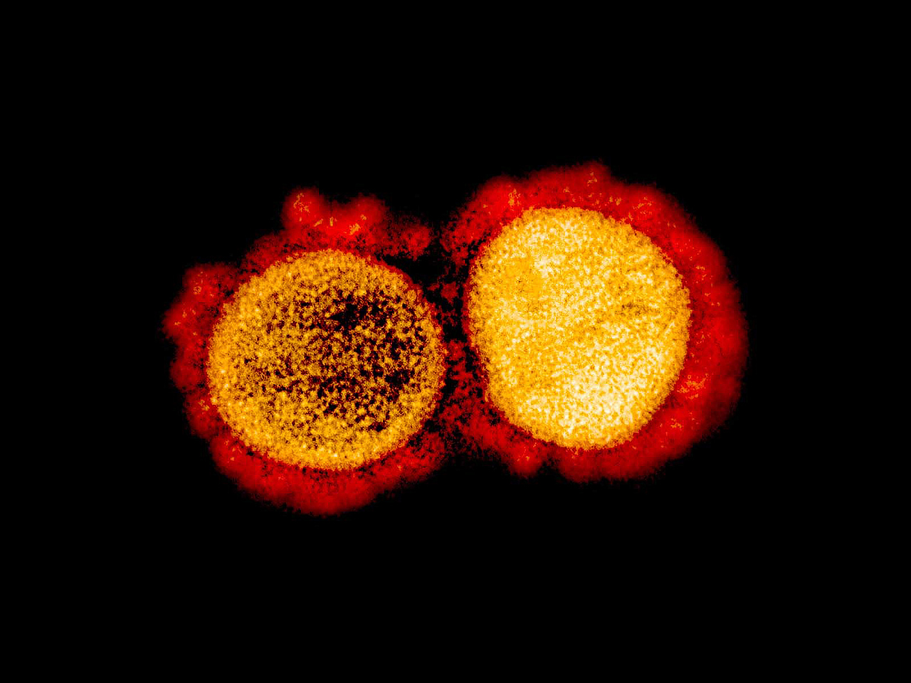 Micrografia eletrônica de transmissão de partículas do vírus Covid-19, isoladas de um paciente. Imagem capturada no NIAID Integrated Research Facility (IRF), em Maryland, nos EUA