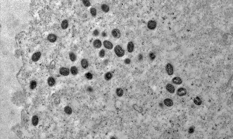 Mpox: solução para emergência global esbarra nas desigualdades entre nações 