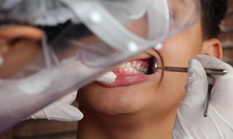 Cáries em adolescentes podem indicar doenças crônicas no futuro, diz estudo