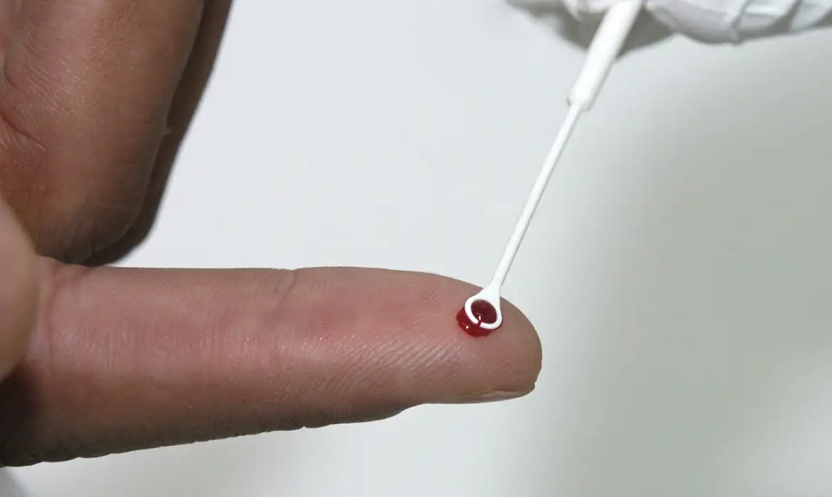 Dia Mundial de Combate à Síndrome da Imunodeficiência Adquirida (Aids) é celebrado nesta segunda-feira (1º)