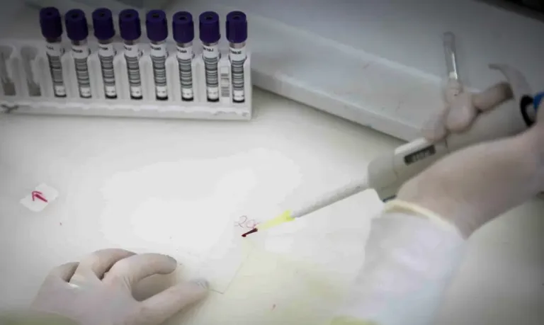 Paciente com suspeita de ebola em SP testa positivo para meningite